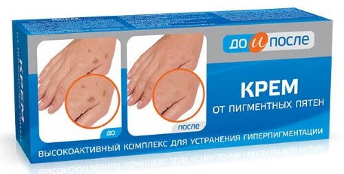 До и После Крем от пигментных и пятен 50мл